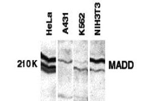 Western Blotting (WB) image for anti-MAP-Kinase Activating Death Domain (MADD) (C-Term) antibody (ABIN1030503) (MADD antibody  (C-Term))