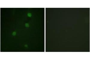 Immunofluorescence (IF) image for anti-Retinoblastoma Protein (Rb Protein) (AA 791-840) antibody (ABIN2888774) (Retinoblastoma Protein (Rb) antibody  (AA 791-840))