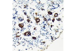 Immunohistochemistry of paraffin-embedded rat bone marrow using Integrin beta 3 (ITGB3/CD61) Rabbit pAb (ABIN6127572, ABIN6142584, ABIN6142586 and ABIN6219636) at dilution of 1:100 (40x lens). (Integrin beta 3 antibody  (AA 610-718))
