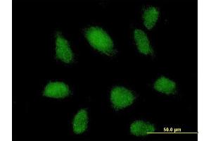 Immunofluorescence of purified MaxPab antibody to TRIM62 on HeLa cell. (TRIM62 antibody  (AA 1-475))