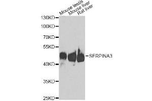 Western blot analysis of extracts of various cell lines, using SERPINA3 antibody. (SERPINA3 antibody  (AA 24-423))