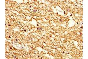 Immunohistochemistry of paraffin-embedded human brain tissue using ABIN7142178 at dilution of 1:100 (Cnpase antibody  (AA 226-415))