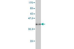 Western Blot detection against Immunogen (38. (CXCL5 antibody  (AA 1-114))