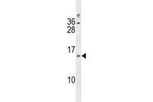 DUSP13 antibody western blot analysis in A2058 lysate (DUSP13 antibody  (AA 147-173))