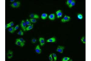 Immunofluorescence staining of HepG2 cells with ABIN7146213 at 1:133, counter-stained with DAPI. (CDH15 antibody  (AA 639-766))