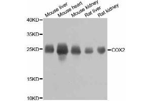 Western blot analysis of extracts of various cell lines, using MT-CO2 antibody. (COX2 antibody)