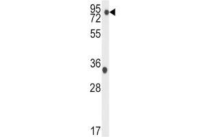 Western Blotting (WB) image for anti-TBK antibody (ABIN3003556) (TBK antibody)