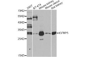 Western blot analysis of extracts of various cell lines, using IGFBP5 antibody (ABIN6292146) at 1:1000 dilution. (IGFBP5 antibody)