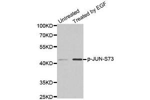 Western blot analysis of extracts from PC14 cells using phospho-JUN-S73 antibody (ABIN2987353). (C-JUN antibody  (pSer73))