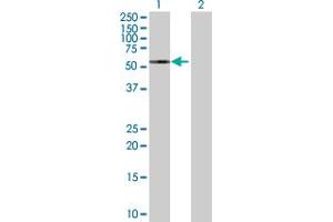 Western Blotting (WB) image for GRN 293T Cell Transient Overexpression Lysate(Denatured) (ABIN1332016)