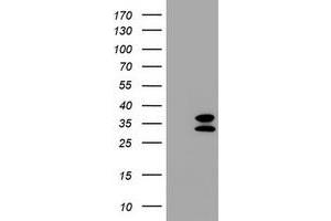 Image no. 2 for anti-Membrane-Spanning 4-Domains, Subfamily A, Member 1 (MS4A1) antibody (ABIN1497208) (CD20 antibody)