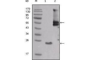 Western Blot showing SRC antibody used against truncated SRC-His recombinant protein (1) and PMA treated THP-1 cell lysate (2). (Src antibody  (AA 10-193))