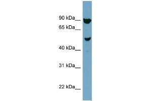 WB Suggested Anti-IRX2 Antibody Titration:  0. (IRX2 antibody  (N-Term))