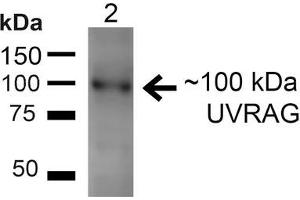 Western blot analysis of Rat Liver showing detection of ~100kDa UVRAG protein using Rabbit Anti-UVRAG Polyclonal Antibody . (UVRAG antibody  (Biotin))