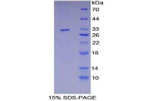 SDS-PAGE analysis of Mouse RYK Protein. (RYK Protéine)