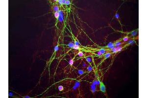 Mixed neuron-glial cultures stained with ABIN1580411, our monoclonal antibody to α-synuclein (red) and chicken polyclonal antibody to MAP2 CPCA-MAP2 (green). (SNCA antibody)