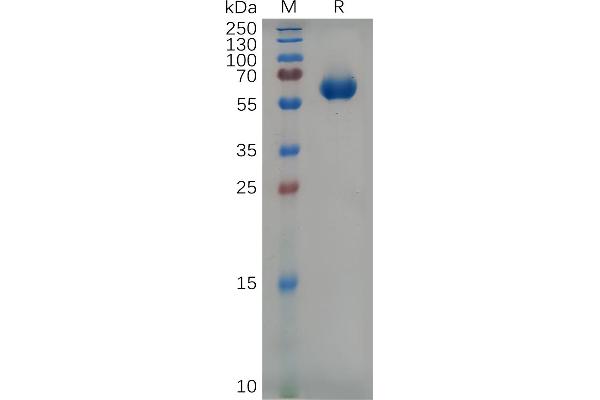 Catalase Protein (CAT) (AA 23-224) (Fc Tag)