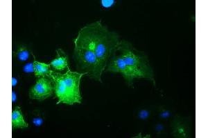 Anti-OSBPL11 mouse monoclonal antibody (ABIN2453406) immunofluorescent staining of COS7 cells transiently transfected by pCMV6-ENTRY OSBPL11 (RC209418). (OSBPL11 antibody)