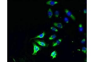 Immunofluorescent analysis of A549 cells using ABIN7163341 at dilution of 1:100 and Alexa Fluor 488-congugated AffiniPure Goat Anti-Rabbit IgG(H+L) (Phospholipase D4 antibody  (AA 52-506))