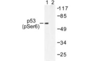 Image no. 2 for anti-Tumor Protein P53 (TP53) (pSer6) antibody (ABIN318095) (p53 antibody  (pSer6))