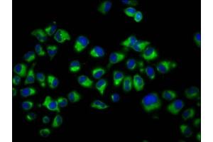 Immunofluorescence staining of Hela cells with ABIN7149086 at 1:200, counter-stained with DAPI. (Cytochrome B Reductase 1 antibody  (AA 220-286))