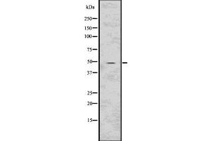 Western blot analysis of HTRA2 using COLO205 whole  lysates. (HTRA2 antibody  (Internal Region))