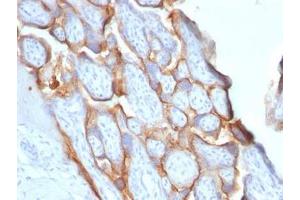 IHC testing of FFPE human placenta with HCG-beta antibody (clone HCGb/1996R). (HCG beta antibody)