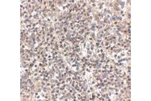 Immunohistochemistry (IHC) image for anti-R-Spondin 1 (RSPO1) (N-Term) antibody (ABIN1031546) (RSPO1 antibody  (N-Term))