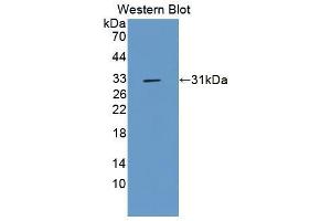 Western blot analysis of the recombinant protein. (UCK2 antibody  (AA 18-261))