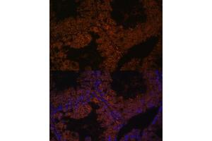 Immunofluorescence analysis of mouse testis using TPD52L3 antibody (ABIN7271079) at dilution of 1:100. (TPD52L3 antibody  (AA 1-132))