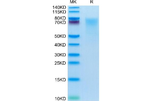 IBSP Protein (AA 17-317) (His tag)