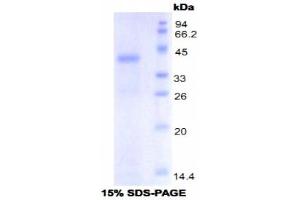 SDS-PAGE analysis of Mouse Toll Like Receptor 4 Protein. (TLR4 Protein)