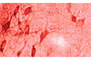 Immunohistochemistry analysis using Rabbit Anti-HO-1 Polyclonal Antibody . (HMOX1 antibody  (APC))