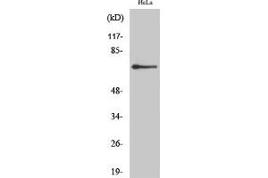 Western Blot analysis of HeLa cells using AR-β2 Polyclonal Antibody diluted at 1:2000. (Androgen Receptor beta 2 antibody  (AA 180-260))