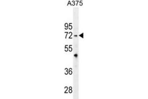 Western Blotting (WB) image for anti-Tripartite Motif Containing 56 (TRIM56) antibody (ABIN2996393) (TRIM56 antibody)