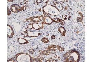 Immunohistochemistry (IHC) image for anti-Keratin 8 (KRT8) (C-Term) antibody (ABIN870549) (KRT8 antibody  (C-Term))