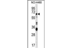 Western blot analysis in NCI-H460 cell line lysates (35ug/lane). (HERV-FRD Provirus Ancestral Env Polyprotein (Herv-frd) (AA 79-107), (N-Term) antibody)