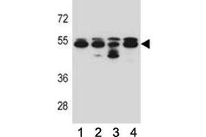 TUBB8 antibody western blot analysis in 293, A549, HepG2, K562 lysate. (Tubulin, beta 8 antibody  (AA 34-62))