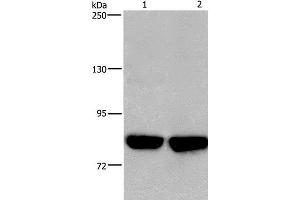 Western Blot analysis of Hela and PC3 cell using PFKP Polyclonal Antibody at dilution of 1:500 (PFKP antibody)