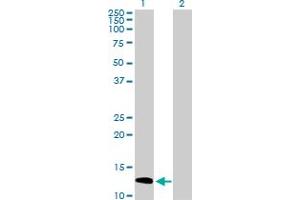 Western Blot analysis of SH2D1A expression in transfected 293T cell line by SH2D1A MaxPab polyclonal antibody. (SH2D1A antibody  (AA 1-128))