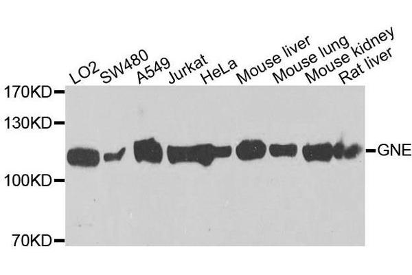 GNE antibody  (AA 1-150)