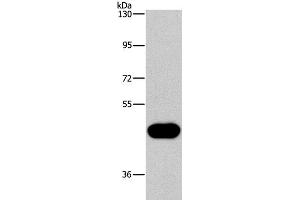 Western Blot analysis of Raji cell using CD38 Polyclonal Antibody at dilution of 1:260 (CD38 antibody)