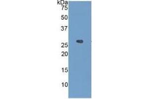 Western Blotting (WB) image for Insulin-Like Growth Factor Binding Protein 4 (IGFBP4) ELISA Kit (ABIN6730875)