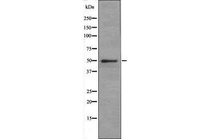 SLC1A5 antibody at 1 µg/ml + Jurkat (Human T cell lymphoblast-like cell line) Whole Cell Lysate. (SLC1A5 antibody  (Internal Region))