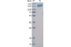 Human CD22, hFc-His Tag on SDS-PAGE under reducing condition. (CD22 Protein (AA 20-687) (Fc-His Tag))
