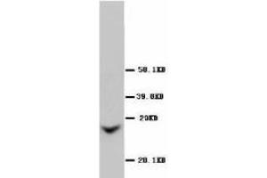Image no. 1 for anti-Gap Junction Protein, beta 2, 26kDa (GJB2) (Internal Region) antibody (ABIN1490360) (GJB2 antibody  (Internal Region))