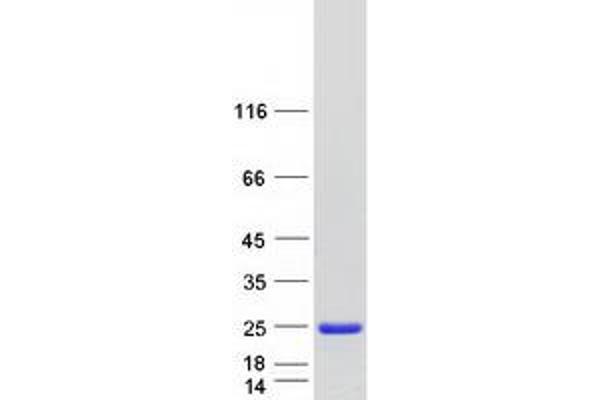 CRYGB Protein (Myc-DYKDDDDK Tag)