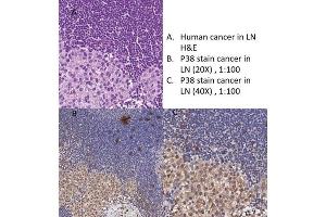 Immunohistochemistry (IHC) image for anti-Mitogen-Activated Protein Kinase 14 (MAPK14) antibody (ABIN6655670)