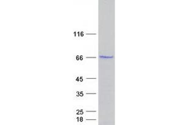 PDLIM5 Protein (Transcript Variant 1) (Myc-DYKDDDDK Tag)