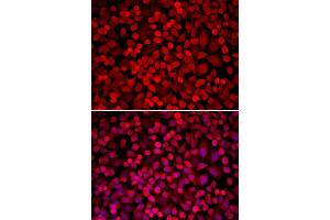 Immunofluorescence analysis of U20S cell using NCOA1 antibody. (NCOA1 antibody  (AA 1222-1441))